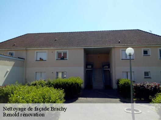 Nettoyage de façade  brachy-76730 Renold rénovation